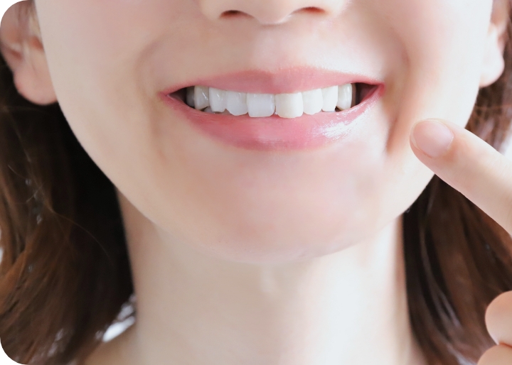 ホワイトニング